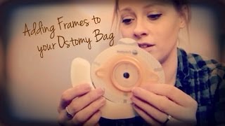 Adding Frames to Your Ostomy Bag  Ostomonday [upl. by Jonas]