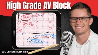 Second Degree “High Grade” AV Block EKG  ECG Lecture [upl. by Lud]