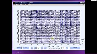 Filter epoch baseline subtraction referencing [upl. by Thirzia35]