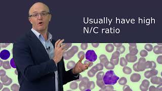 Blast or atypical lymphocyte How you can pick the difference [upl. by Rayford]