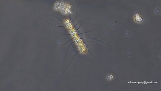 Chaetoceros diatomeas  diatoms [upl. by Ramal]