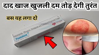 दाद खाज खुजली दम तोड़ देगी तुरंत बस यह लगा दो  Paamderm Plus Cream To Treat Fungal Infection [upl. by Rim252]