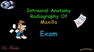 Normal radiographic anatomical landmarks Intraoral Radiographic Anatomy of the Maxilla Dental exam [upl. by Ojytteb]