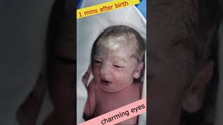 Cute newborn baby with charming eyes immediately after birth 😍 cutebaby [upl. by Aiekam]