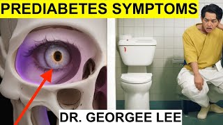 ⚡️Top 10 Prediabetes Symptoms You MUST AVOID Reverse Prediabetes [upl. by Eessac775]