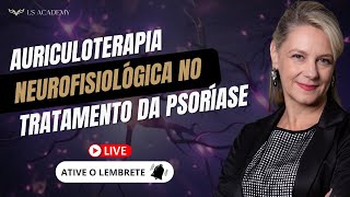 AURICULOTERAPIA NEUROFISIOLÓGICA NO TRATAMENTO DA PSORÍASE [upl. by Alderman]