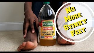 How To Get Rid Of Foot Odor Apple Cider Vinegar [upl. by Onitnelav350]