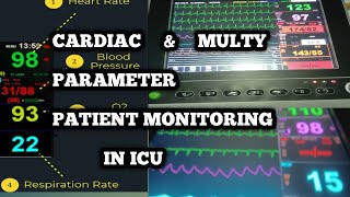 CARDIAC AND MULTI PARAMETERS PATIENTS MONITORING IN CRITICAL CARE UNITMEDICAL TECHNOLOGIST MT CCU [upl. by Ynaffet133]