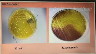 🤓🥳Enterobacteriaceae العملي 🤓😷 [upl. by Nanor]