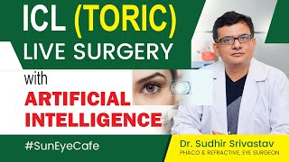 ICL Eye Surgery  Specs removal for High Numbers  ICL Toric Surgery refractivesurgery suneyecafe [upl. by Lathe71]