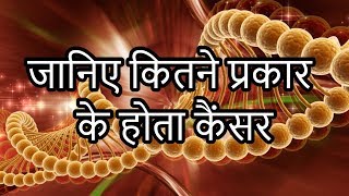 कैंसर के प्रकार  Cancer ke Prakar  Types of Cancer In Hindi [upl. by Bliss]