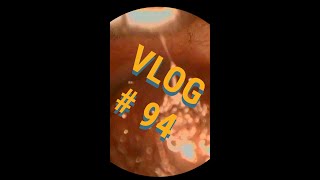 VLOG 94  What a mess GOOEY ear wax strikes again [upl. by Teeniv]