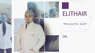 Haartransplantation Erfahrungen  Elithairtransplant  Dr Balwi [upl. by Lamori199]