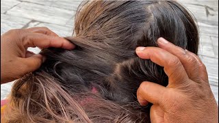 Mom remove lice from school girl hair at home vlog hair makeover 3 [upl. by Airym]