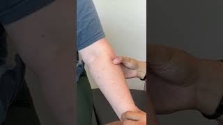 Painful Elbow Examination chiropractictreatment [upl. by Graeme]