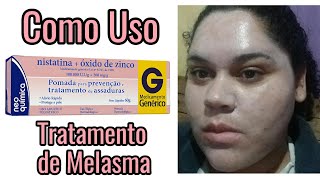 Pomada Nistatina pra Melasma  Como Aplico [upl. by Charis]