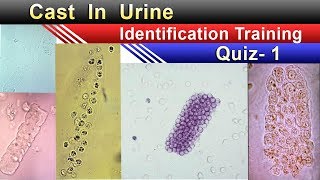 Urine Cast Identification Training Quiz 1 [upl. by Htilil79]