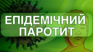 Епідемічний паротит quotсвинкаquot  фактор ризику чоловічого безпліддя  Mumps Virus [upl. by Cherey]