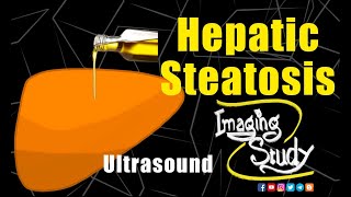 Hepatic Steatosis  Fatty Liver  Ultrasound Lecture  Imaging Study [upl. by Isador]