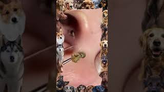 Blackhead Removal  Pore of winer 2024 blackheads [upl. by Nitsirhc]