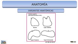 ANOMALÍAS PÁNCREAS POR TOMOGRAFÍA [upl. by Ecinnaj228]