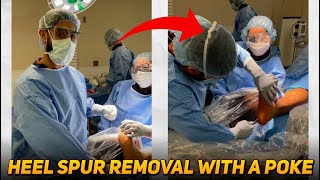 Heel Spur Surgery With a Small Poke [upl. by Rutherfurd]