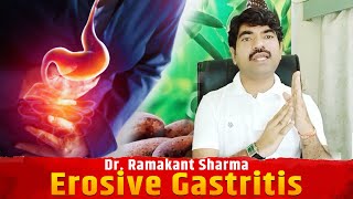 what is erosive gastritis  erosive gastritis symptoms। Dr Ramakant Sharma [upl. by Aman207]