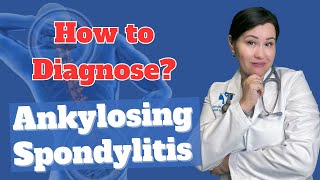 How to Diagnose Ankylosing spondylitis  Dr Diana Girnita [upl. by Nnairak]