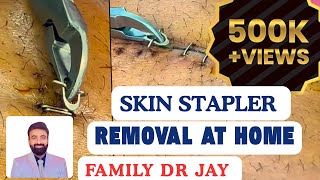 Skin stapler removal at home  Dr JAY  SELF GUIDE  DIY  STITCHES [upl. by Nils]