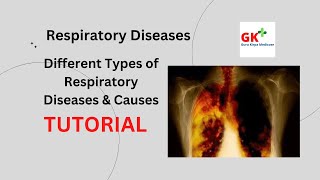 The Silent Killer of Respiratory Disease You Need to Know About [upl. by Gardener822]