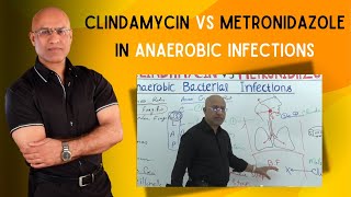 Clindamycin vs Metronidazole  Anaerobic Infections [upl. by Ardelle]