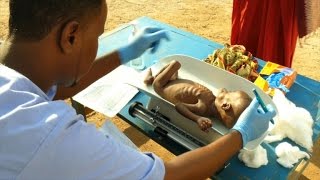 Malnutrition at record high in droughthit Somalia ICRC [upl. by Goss]