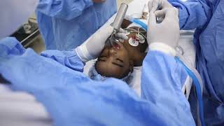 Pediatric Anesthesia for a 5MonthOld Baby with a Cleft Lip and Palate [upl. by Eisaj]