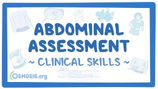 Abdominal Assessment Clinical Skills [upl. by Ellehsim]