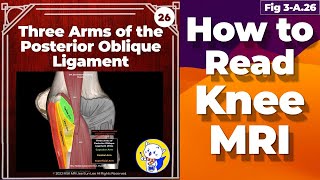 Fig 3A26 Three arms of the posterior oblique ligament anatomy [upl. by Feliks]