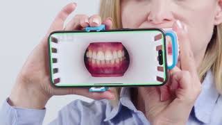 Invisalign Virtual Care [upl. by Eran392]