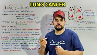 Lung Cancer Stages of cancer Causes Symptoms and treatment [upl. by Hey]