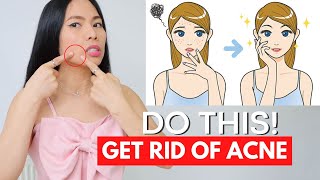 DO THIS to get rid of acne now amp forever keep skin clear 2 min daily facial massage [upl. by Xonk603]