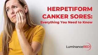 Herpetiform Canker Sores Everything You Need to Know [upl. by Limemann]