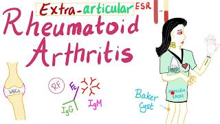 Rheumatoid arthritis RA Signs and Symptoms  Extraarticular manifestations  Part 6 [upl. by Enitsed72]