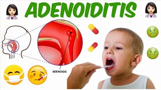 PharyngoTonsillitis and Adenoiditis  Part 2  ENT [upl. by Netfa]