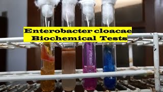 Enterobacter cloacae Biochemical tests Demonstration [upl. by Strickland67]