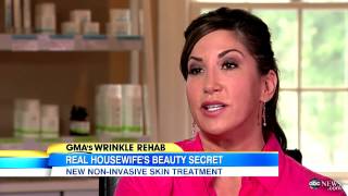 Real Housewives Jacqueline Laurita Ultherapy Treatment Star Reveals AntiAging Secret [upl. by Mitchael]