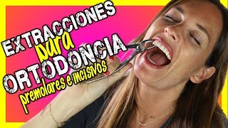 😱 𝐄𝐗𝐓𝐑𝐀𝐂𝐂𝐈𝐎𝐍 𝐝𝐞 𝐏𝐑𝐄𝐌𝐎𝐋𝐀𝐑𝐄𝐒 superiores e inferiores en ORTODONCIAQuitar DIENTES para poner BRACKETS [upl. by Jerry]