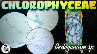 Oedogonium spthallus structure paperpenbiology Chlorophyceae [upl. by Rafaelle]