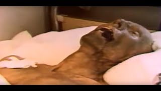 Acute radiation syndrome the Ministry of defense of the USSR 1988 HD [upl. by Fortuna602]