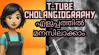 TTUBE CHOLANGIOGRAPHY Complete study explained in Malayalam [upl. by Charmian]