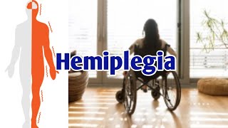 Partial Paralysis Hemiplegia amp its Treatment [upl. by Eentroc]