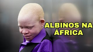 ALBINOS NA ÁFRICA [upl. by Tombaugh]