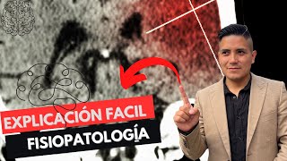 ✅Ictus Isquémico Fisiopatología 1 ABP Adulto Séptimo🧠 [upl. by Sophy]